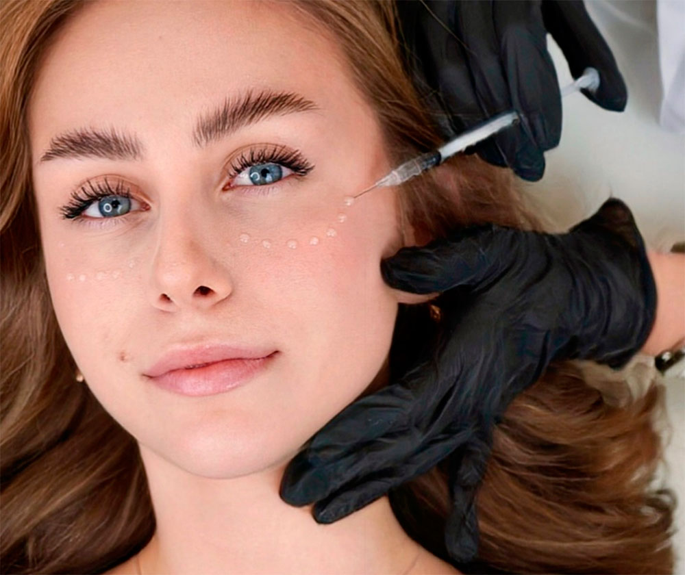 Биоревитализация - Juvederm, Aquashine, Neauvila, Rejuran