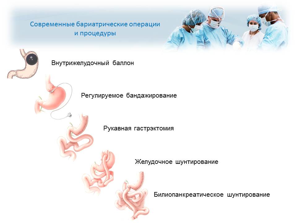Бариатрическая хирургия - хирургия против ожирения